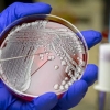 As 15 bactérias mais perigosas para a saúde humana